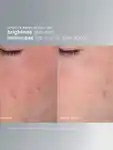 Alternative Image DERMALOGICA Daily Microfoliant40g