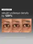 Alternative Image DERMALOGICA Smart Eyedensity Serum