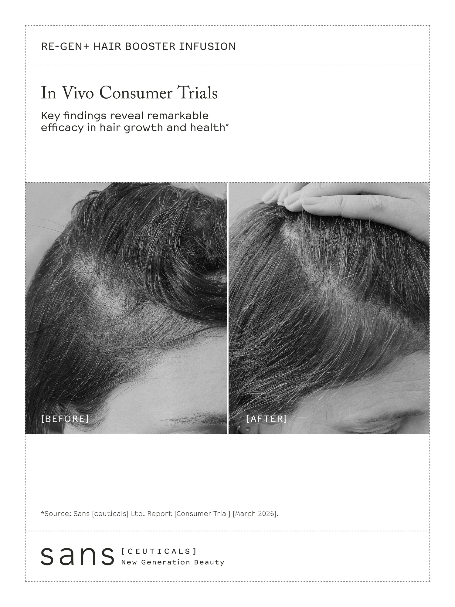 Alternative Image Sans Ceuticals Re Gen Hair Booster Infusion