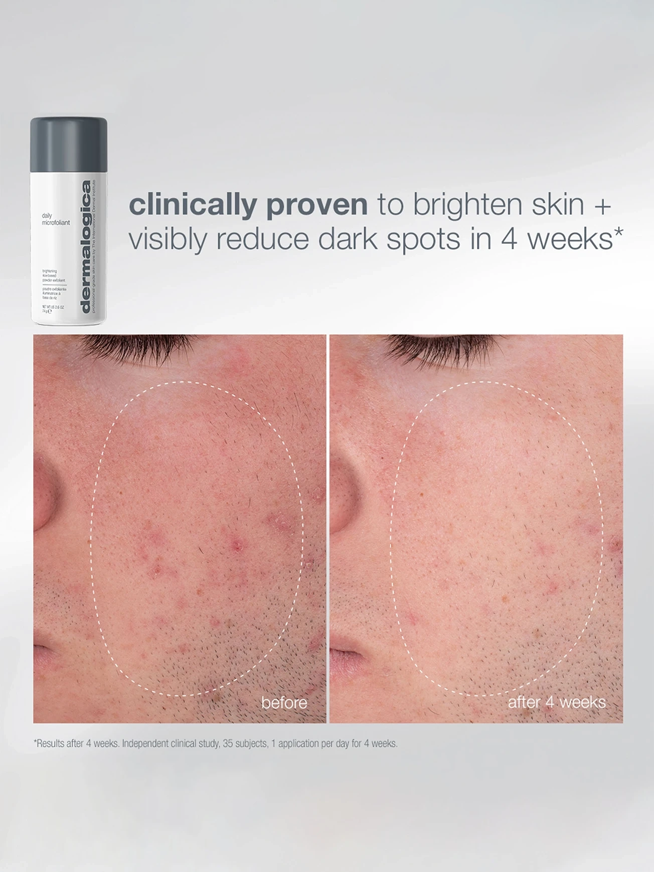 Alternative Image DERMALOGICA Expert Cleanse And Glow