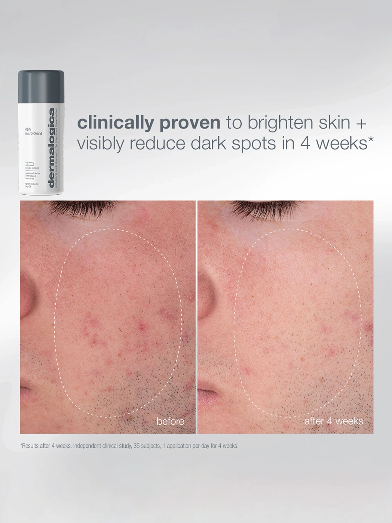 Alternative Image DERMALOGICA Glow On The Go