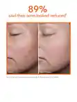 Alternative Image DRDENNISGROSS Limited Edition Drx Spectralite Faceware Pro Gold Glitter