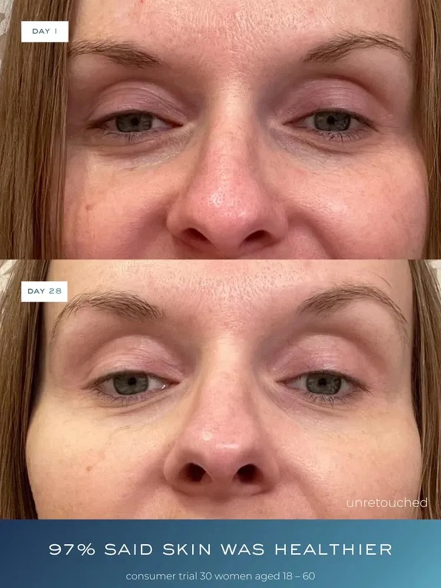 Alternative Image ELEMENTEIGHT O2 Skin Longevity Duo