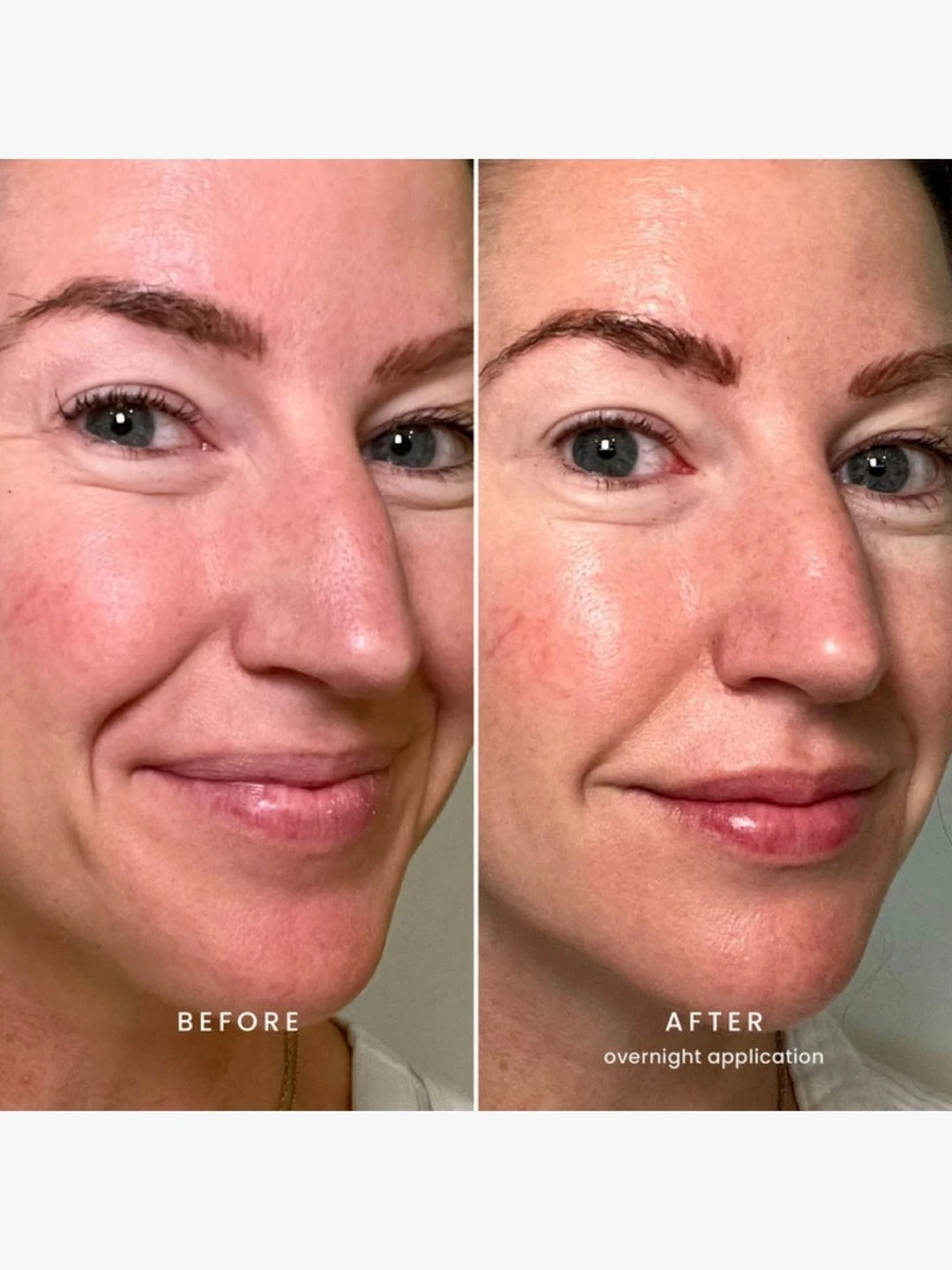 Differant Masks KARUNA Collagen Hydrogel Face Mask | MECCA