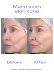 Alternative Image SKINSTITUT 10 Glycolic Acid Overnight Peel
