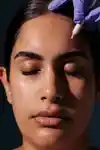 Rejuran® Skin Booster image 1