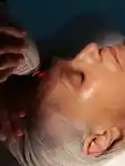 Clear & Brilliant™ Laser Renewal 45 Minutes | $440.00
