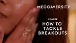 video-fallback-image