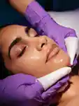 Melanopro Peel System Consultation image 1