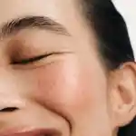 Memo How To Fix Over Exfoliated Skin Square 1x1